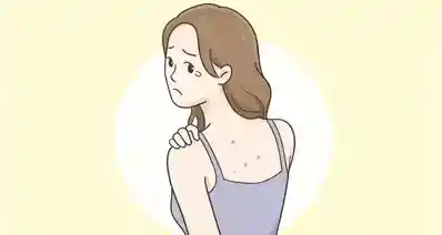 后背痘痘到底是什么？怎么祛除？